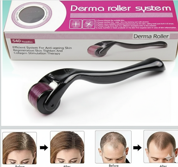 Dermaroller 1.5mm titanium needle